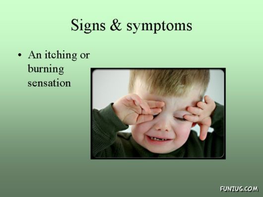 Know Everything About Conjunctivitis