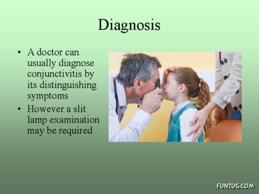 Know Everything About Conjunctivitis