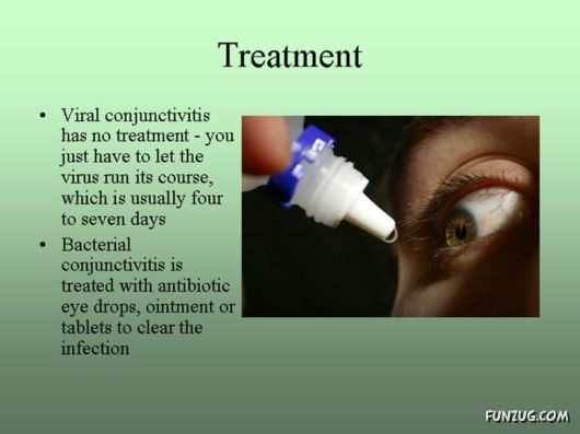 Know Everything About Conjunctivitis