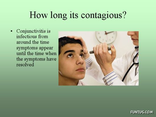 Know Everything About Conjunctivitis