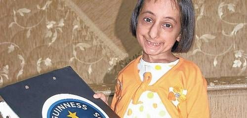 World's Shortest Woman